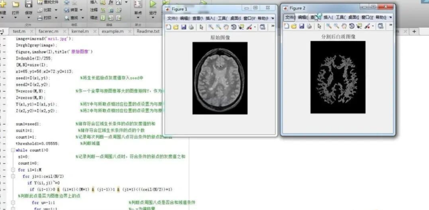 mosek macos matlab